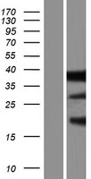 CLM 9 (CD300LG) Human Over-expression Lysates NM_001168322