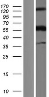 CLM 9 (CD300LG) Human Over-expression Lysates NM_001168323