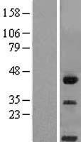 CLM 9 (CD300LG) Human Over-expression Lysates NM_145273