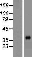 PROCA1 Human Over-expression Lysates NM_152465