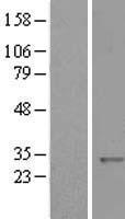KCTD11 Human Over-expression Lysates NM_001002914
