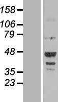 NOTUM Human Over-expression Lysates NM_178493