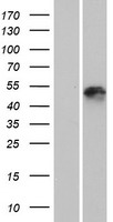 ls147183 krt25 human over expression lysates nm 181534 wb testing 1