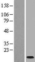 ls147199 scgb1c1 human over expression lysates nm 145651 wb testing 1