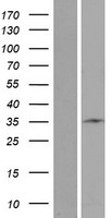 STARD6 Human Over-expression Lysates NM_139171