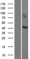 CCBE1 Human Over-expression Lysates NM_133459