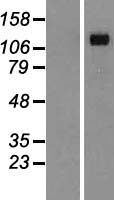 Desmoglein 4 (DSG4) Human Over-expression Lysates NM_177986
