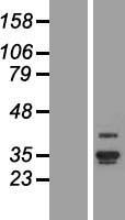 ls147463 ankrd29 human over expression lysates nm 173505 wb testing 1