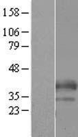 C19orf18 Human Over-expression Lysates NM_152474