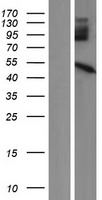 ls147699 ppm1n human over expression lysates nm 001080401 wb testing 1