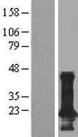 TMEM190 Human Over-expression Lysates NM_139172