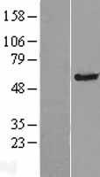 TMC4 Human Over-expression Lysates NM_144686