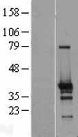 ls147807 znf524 human over expression lysates nm 153219 wb testing 1