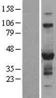 ls147808 znf784 human over expression lysates nm 203374 wb testing 1