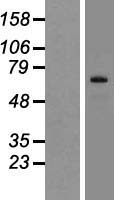 SIX5 Human Over-expression Lysates NM_175875