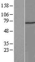 ZNF583 Human Over-expression Lysates NM_001159860