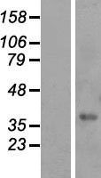 ls147965 fam98c human over expression lysates nm 174905 wb testing 1