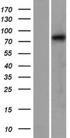 Calpain 12 (CAPN12) Human Over-expression Lysates NM_144691