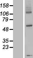 ls147991 dpy19l3 human over expression lysates nm 207325 wb testing 1