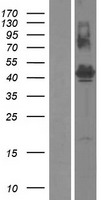 FAM187B Human Over-expression Lysates NM_152481