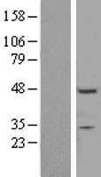 ZNF558 Human Over-expression Lysates NM_144693