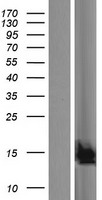 C19orf25 Human Over-expression Lysates NM_152482