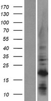C1orf52 Human Over-expression Lysates NM_198077