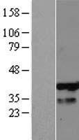 ls148479 phf13 human over expression lysates nm 153812 wb testing 1