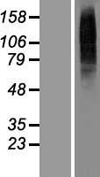 TLCD4 Human Over-expression Lysates NM_152487