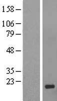 C1orf150 (GCSAML) Human Over-expression Lysates NM_145278