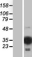 MOBKL2C (MOB3C) Human Over-expression Lysates NM_201403