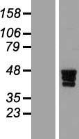 ZNF362 Human Over-expression Lysates NM_152493