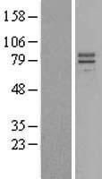IL23 Receptor (IL23R) Human Over-expression Lysates NM_144701