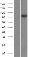 EXOC8 Human Over-expression Lysates NM_175876