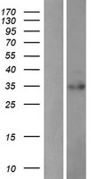 PDIK1L Human Over-expression Lysates NM_152835