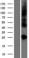 CLDN19 Human Over-expression Lysates NM_148960