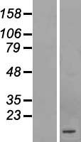 C1orf210 Human Over-expression Lysates NM_182517