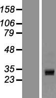 ls149473 ccdc24 human over expression lysates nm 152499 wb testing 1