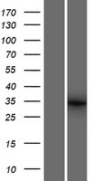 BTBD19 Human Over-expression Lysates NM_001136537