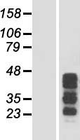 CCDC17 Human Over-expression Lysates NM_152500