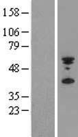 PYHIN1 Human Over-expression Lysates NM_152501