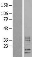 ls149708 wfdc5 human over expression lysates nm 145652 wb testing 1