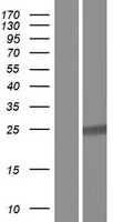 COMMD7 Human Over-expression Lysates NM_001099339