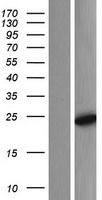 COMMD7 Human Over-expression Lysates NM_053041