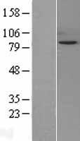 Snf1lk (SIK1) Human Over-expression Lysates NM_173354