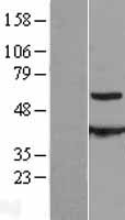 CESK1 (CCT8L2) Human Over-expression Lysates NM_014406