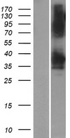 ls150223 ydjc human over expression lysates nm 001017964 wb testing 1