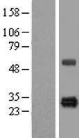 HSCB Human Over-expression Lysates NM_172002
