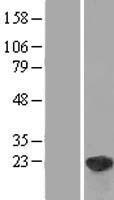 DUSP18 Human Over-expression Lysates NM_152511