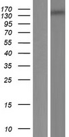 ls150365 mei1 human over expression lysates nm 152513 wb testing 1